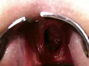 creampie reife sex h ...